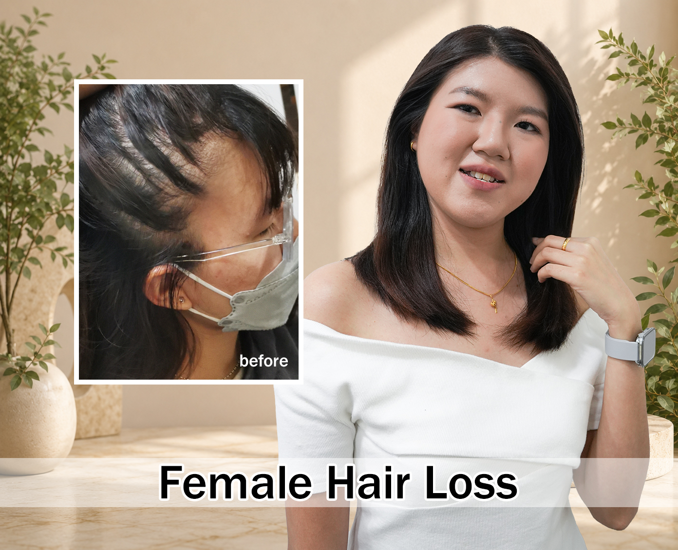 Before and after hair result 1